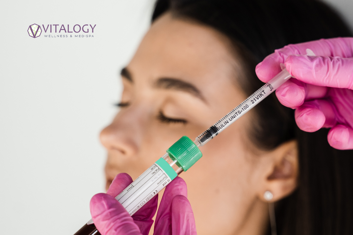 PRP therapy at Vitalogy Wellness and Med Spa