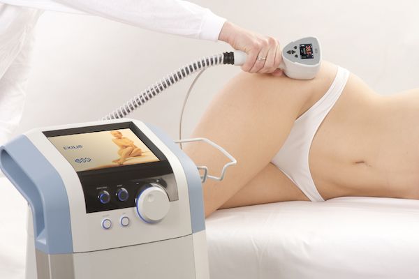 Exilis for Skin tightening at Vitalogy Wellness