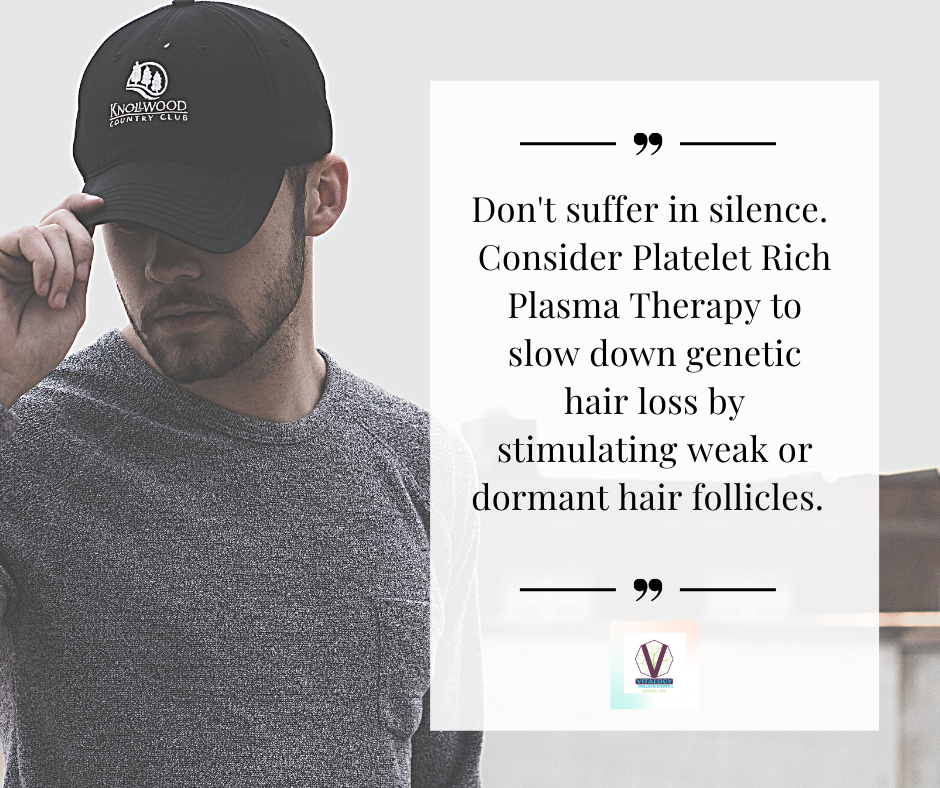 PRP stimulates hair growth in dormant follicles- PRP Hair Loss Treatment at Vitalogy and Medical Spa